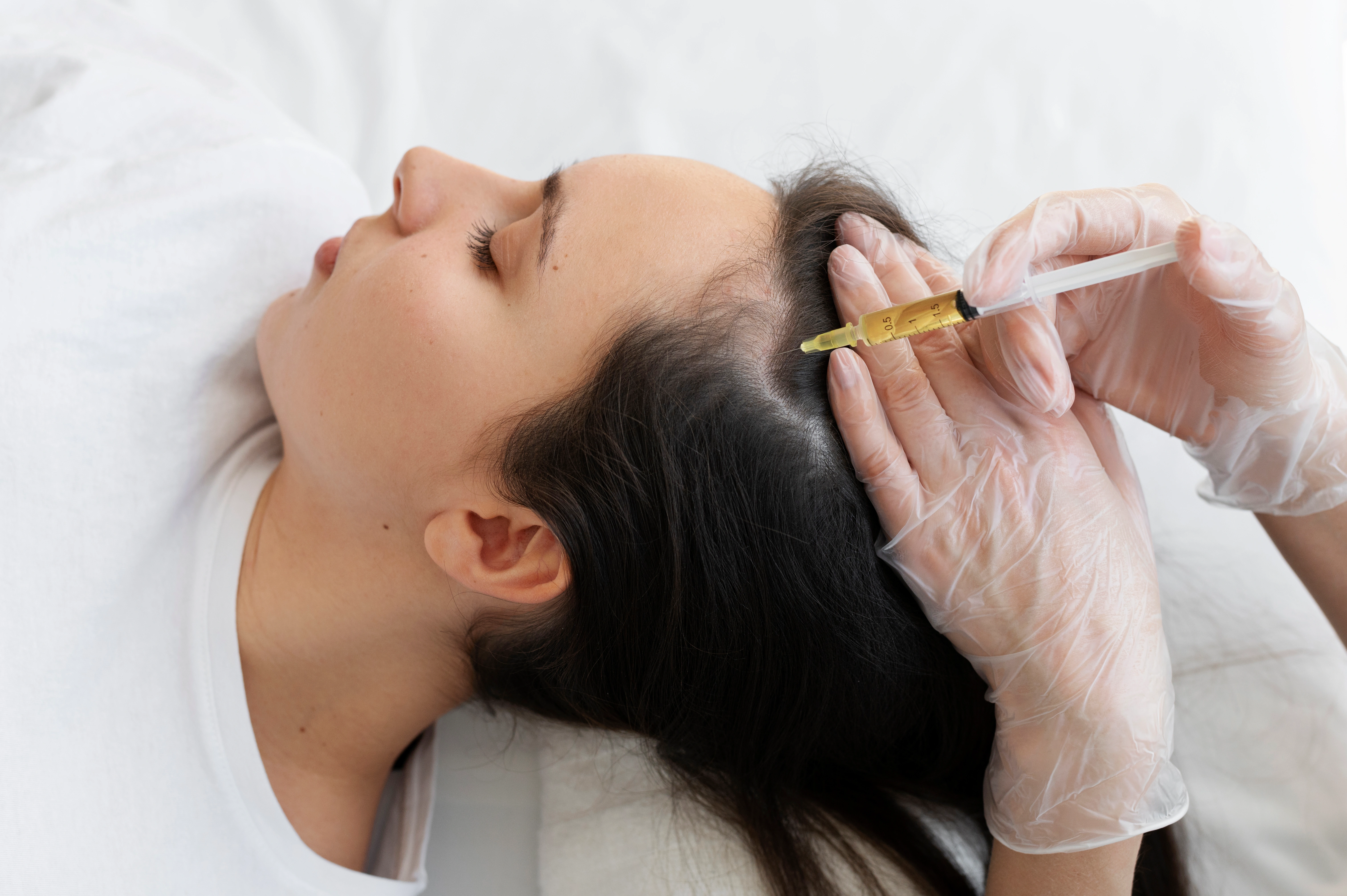 Hair PRP treatment showcase